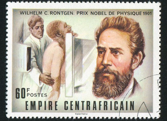 Paprsky X, které umožňují nahlédnout do lidského těla doslova až „na kost“.